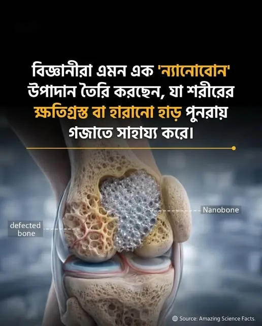 কৃত্রিম বোন-গ্রাফট